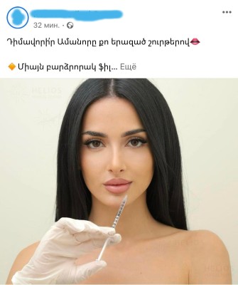 Գովազդի աստվածները կատաղել են․ ամեն ինչ լսել էինք,  բայց «դիմավորիր Ամանորը քո երազած շուրթերով»՝ չէինք լսել
