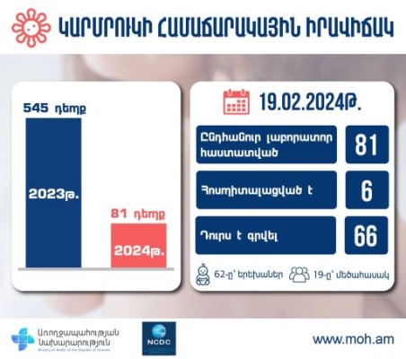 Հայաստանում գրանցվել է կարմրուկի հաստատված 81 դեպք