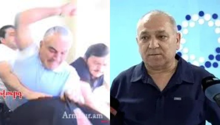Բժիշկը մանրամասներ է հայտնել Արթուր Չախոյանի առողջական վիճակի մասին