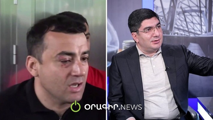 Պատիվ և պատասխան ենք պահանջում Տիգրան Ավինյանից. Մեսրոպ Մանուկյան
