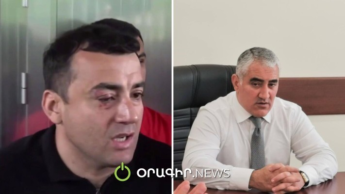 Անհերքելի փաստերով արձանագրված է, որ «թաղապետը» զանգահարել է Չախոյանին և միտումնավոր սպառնացել. տեսանյութ