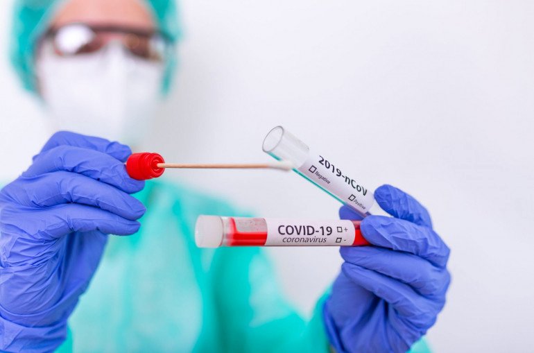 ԱՊՀ-ն քննարկում է COVID-19-ի դեմ պատվաստումների վկայականների փոխադարձ ճանաչման հարցը